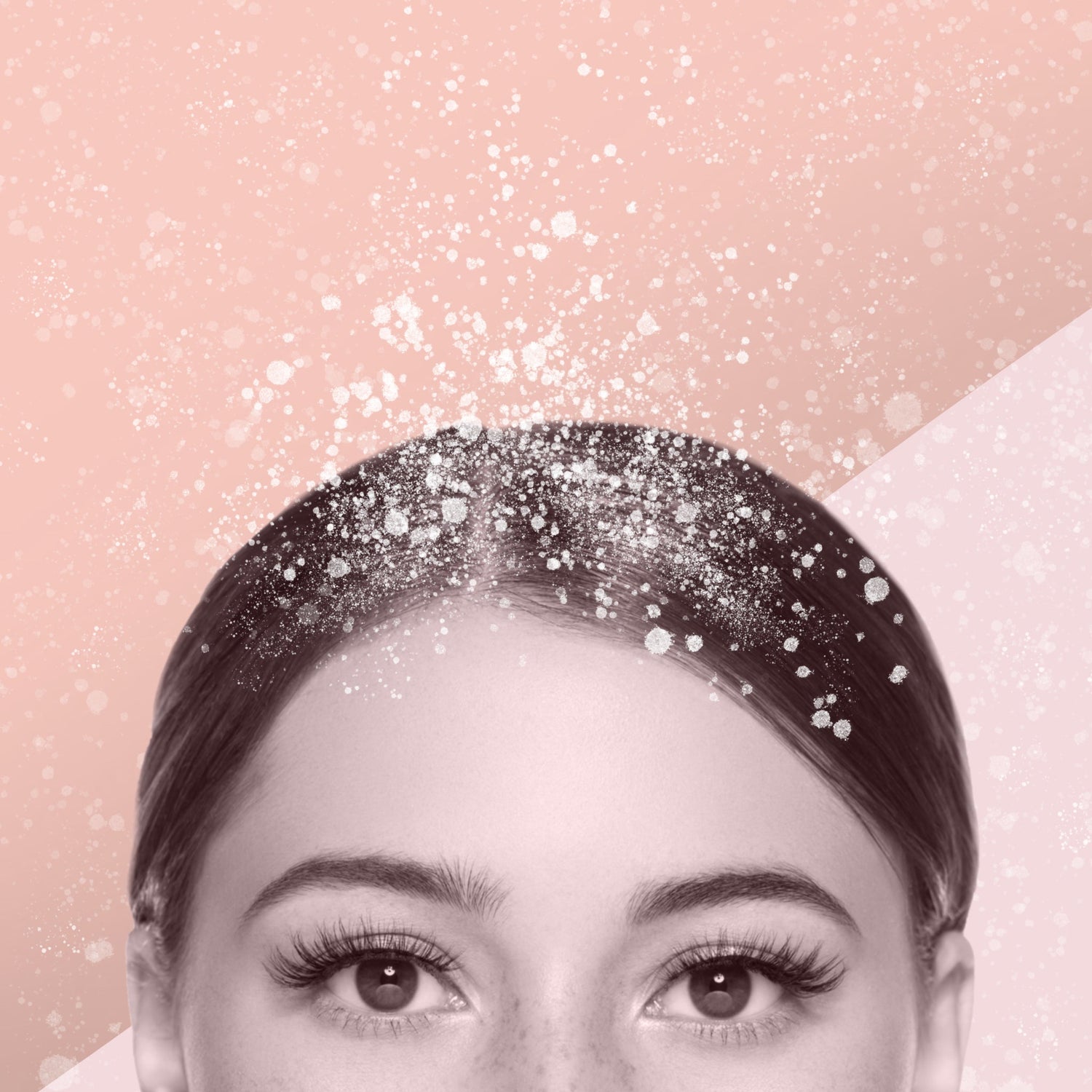 Kepek Problemim Bitmiyor! 3 Büyük Nedeni